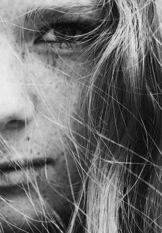 점이 생기는 이유로 관련된 사진 - 5