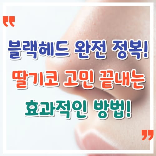 블랙헤드-완전-정복-딸기코-고민-끝내는-200-효과적인-방법