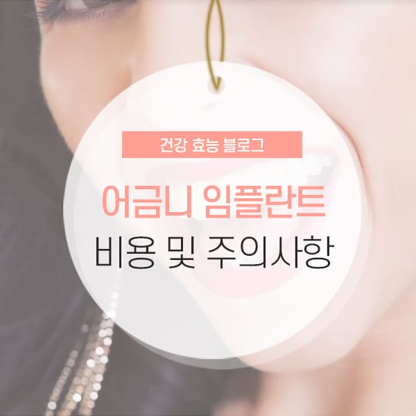 어금니 임플란트 가격 및 부작용 소개 콘텐츠