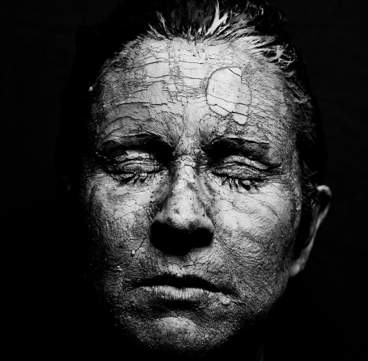 각질이 생기는 이유와 심한 원인