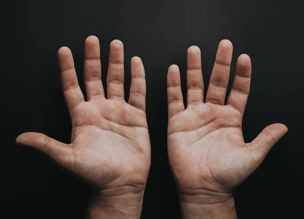 손가락 봉와직염