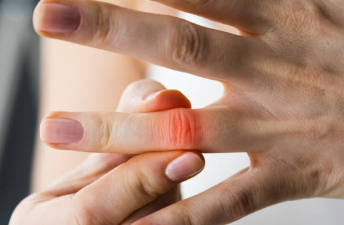 손가락 마디 통증