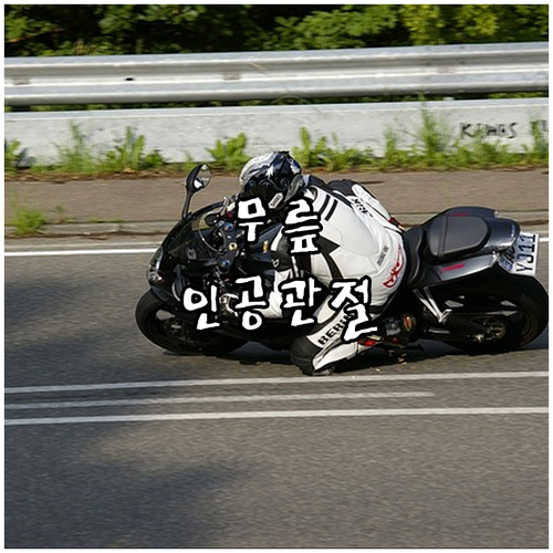 무릎 인공관절 치료: 통증 완화와 활..