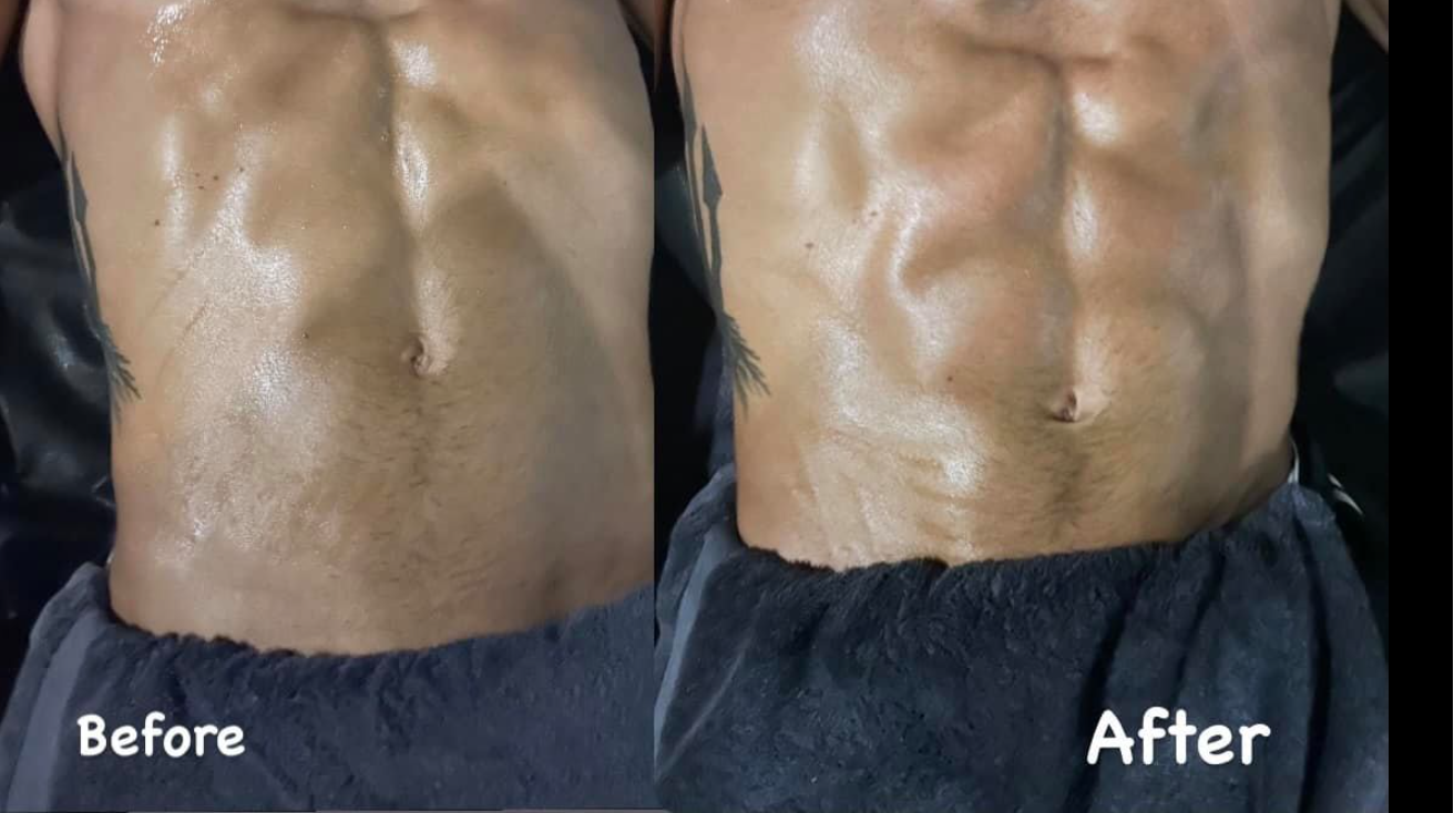 근막이완술 치료 전 과 후 비교