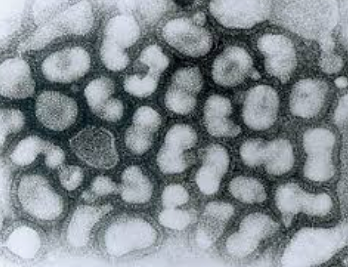 A형독감-바이러스