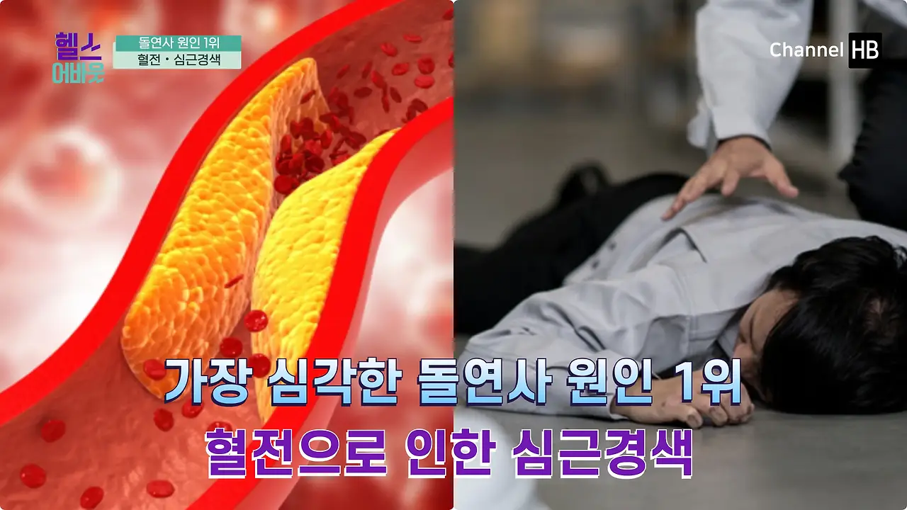 혈전용해제 나토키나제