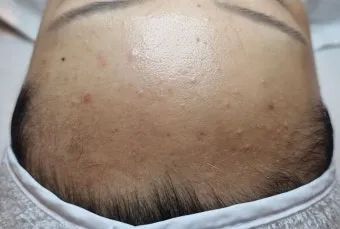 남자 얼굴 피지 제거 화장품 꿀템_26