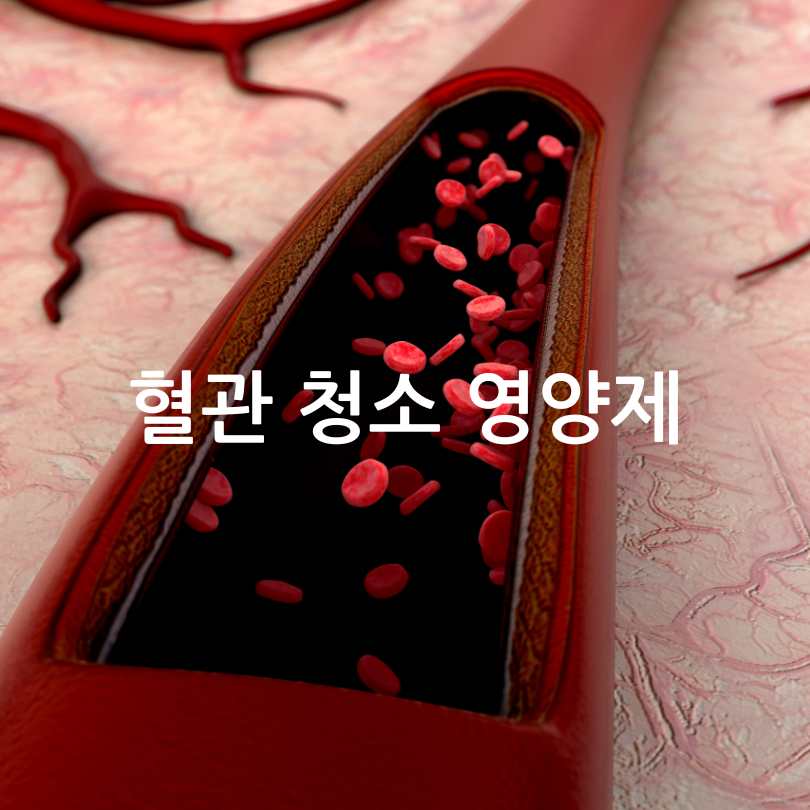 혈관청소하는 주사 : 킬레이션주사 가격과 효과