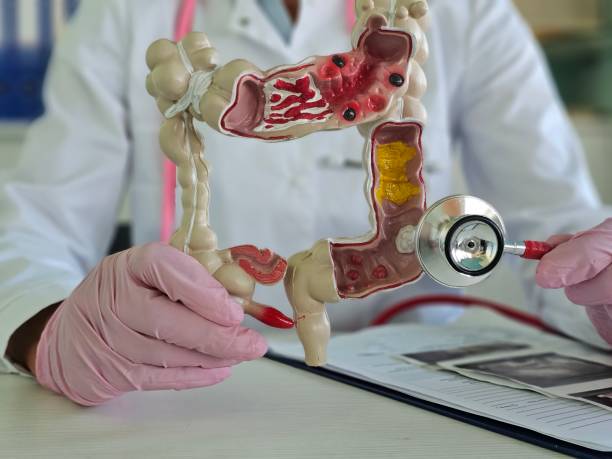 의사가 장모형 들고 있는 사진