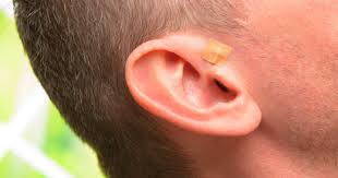 건강보험 적용되는 (알레르기, 비염) 한방치료