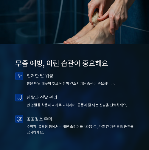 무좀 원인, 증상, 치료 및 예방법
