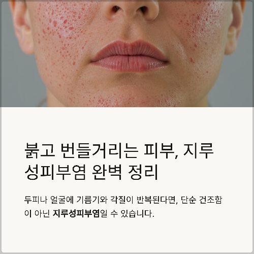 붉고 번들거리는 피부, 지루성피부염 완벽 정리
