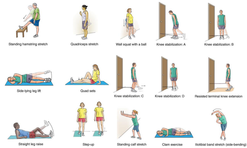 슬개대퇴과압박증후군 재활,연골연화증 재활