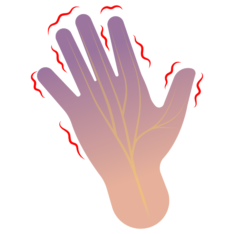 손목터널증후군 증상