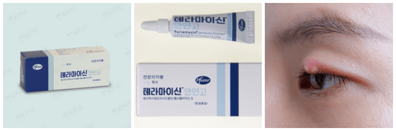 테라마이신 안연고, 다래끼 사진