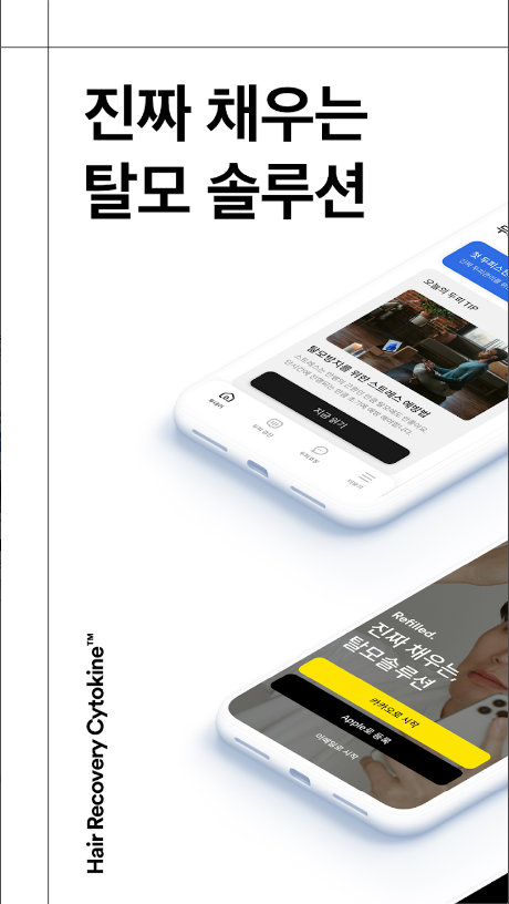 리필드 - 탈모 케어 솔루션