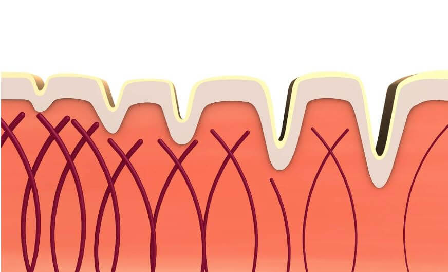 피부층 단면 모습