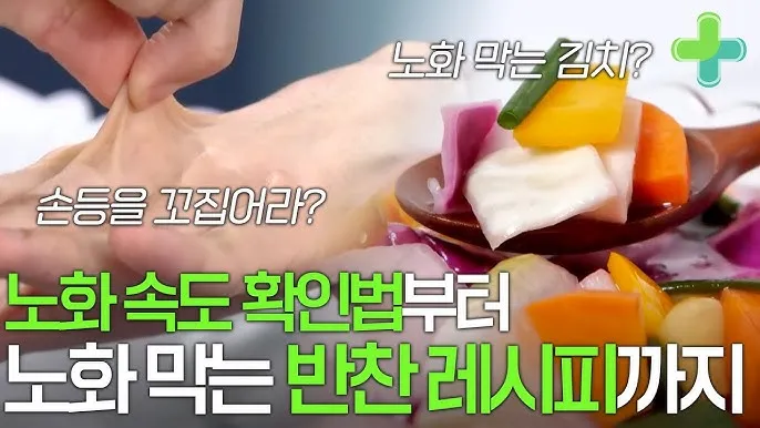 손등 붓는 이유 혈액순환 문제 증상과 해결법 정리_6