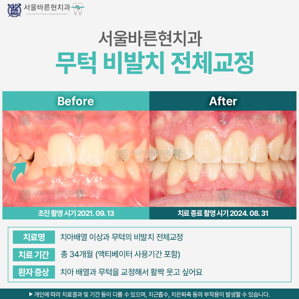 해운대교정치과