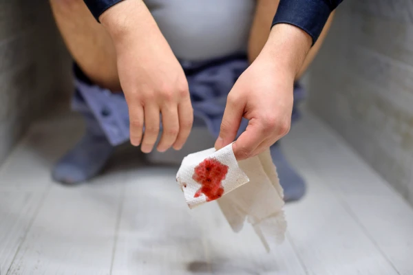 치질 수술 후 첫 대변은 가장 고통스러운 순간입니다. 출혈과 진물이 발생하는 것은 당연한 일입니다.