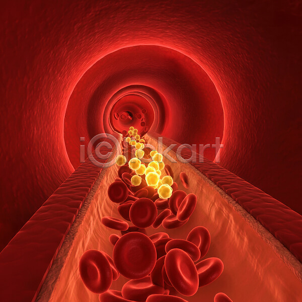 혈당스파이크 증상