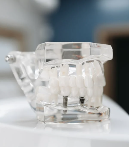 임플란트 의료보험적용대상 조건