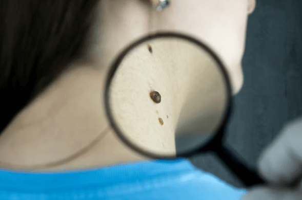 비급여 병원비 줄이는 실전 절약 꿀팁 7가지