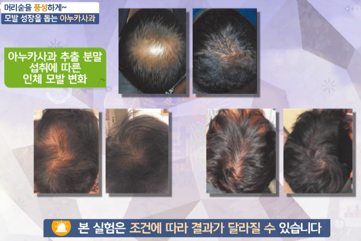 아누카사과 분말 효능