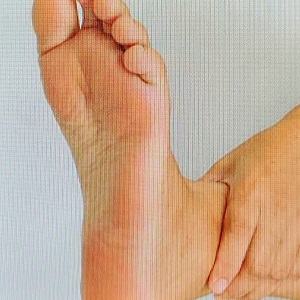 발바닥통증의 원인