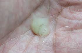 목에 가래가 생기는 원인