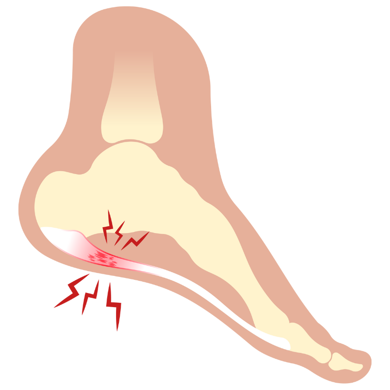 발뒤꿈치 통증 원인