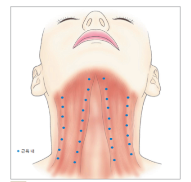인천성형외과 목주름리프팅