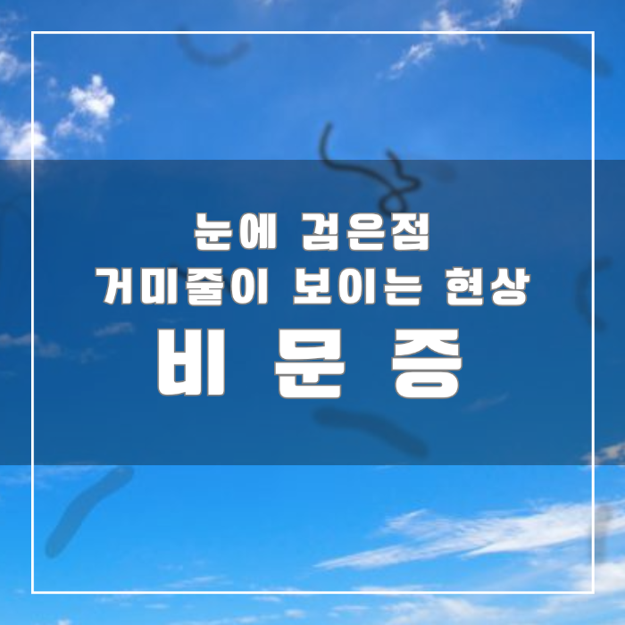 눈에 검은점 거미줄이 보이는 현상 비문증
