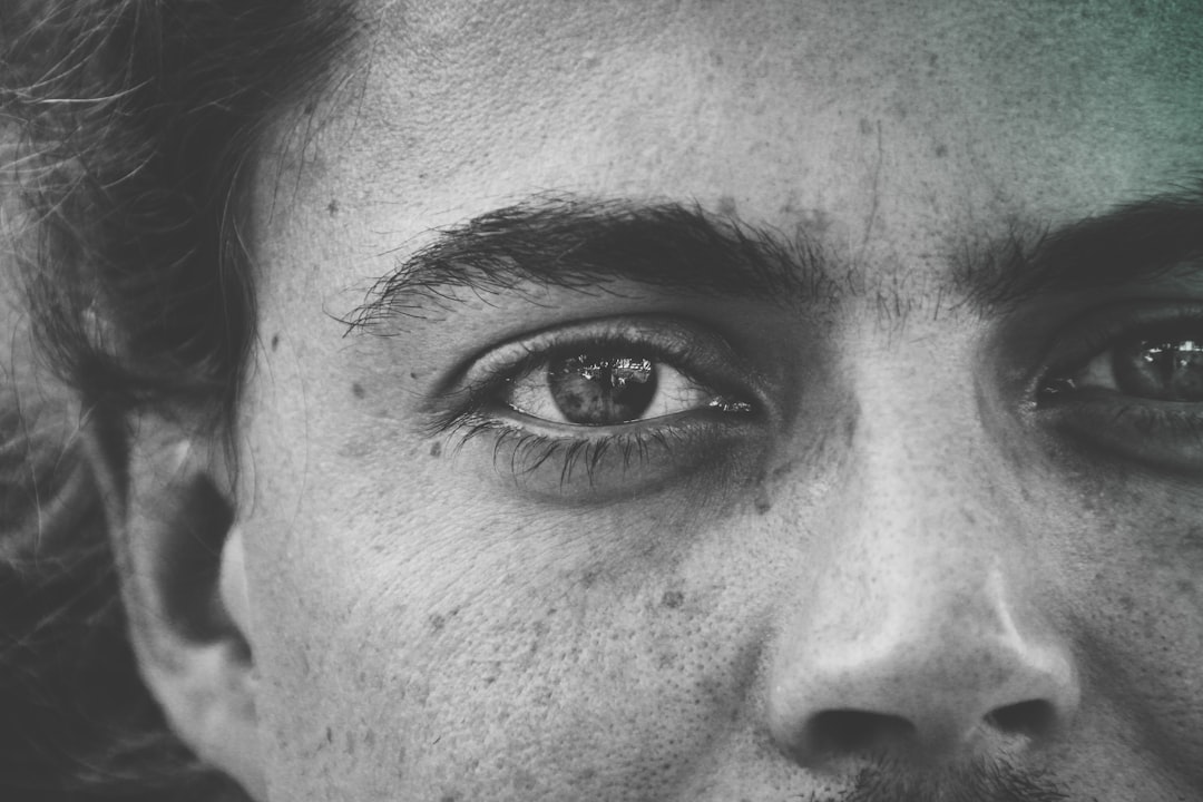 Eyelid.