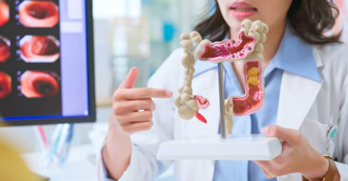 대장암과 관련된 사진1