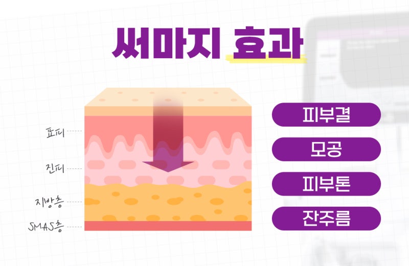 울세라 써머지