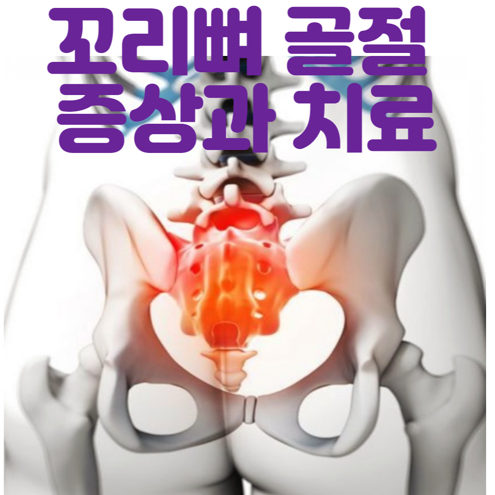 꼬리뼈통증