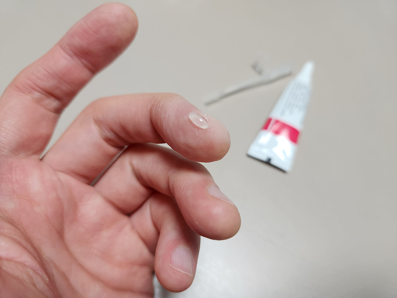 칼에베인-손가락상처-프리덤폼-발라주기