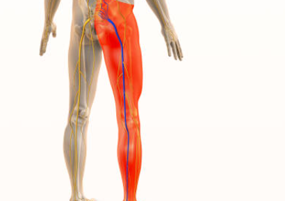 좌골신경통 증상 치료 좌골신경통에 좋은 운동 피해야 할 운동 침치료 효과