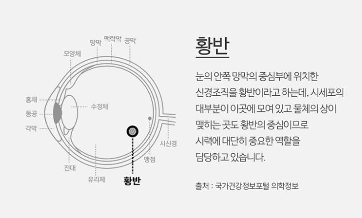 황반2