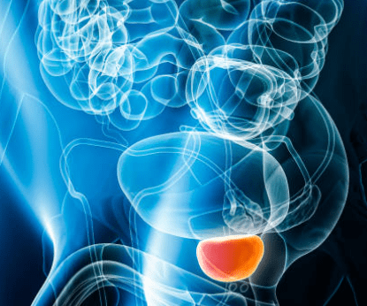 전립선비대증 치료방법 수술비용