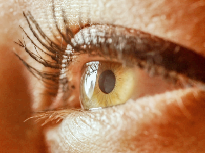 눈 다래끼 원인과 빨리 낫는 법