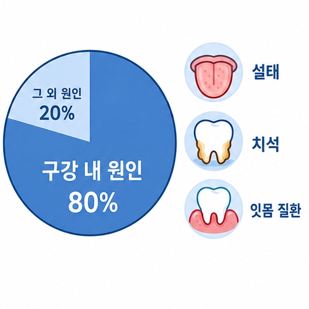 구취 원인 구강 내외 비율 비교
