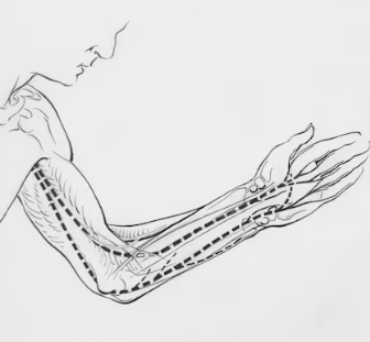 고지혈증에 좋은 음식 나쁜 음식