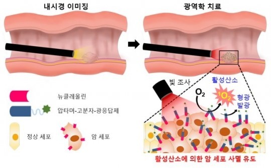 치료장비의 발전