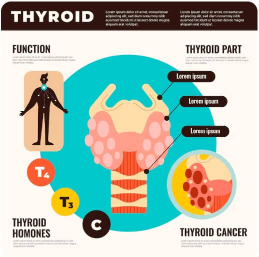 갑상선 기능 저하증 증상을 설명하는 모습