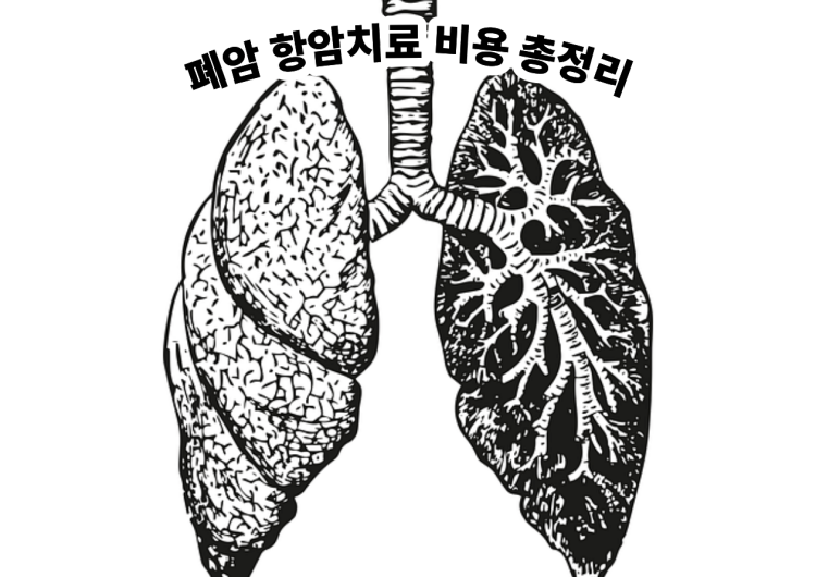폐암 항암치료 비용 총정리