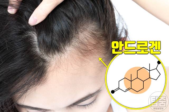 머리냄새 원인 폐경 호르몬 머리냄새없애는법