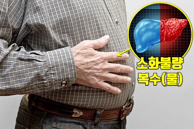 배에 가스가 차요 소화불량, 간이 안좋을때 나타나는 증상, 간암 간경화 지방간 증상, 건강, 팁줌 매일꿀정보