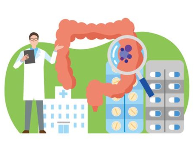 대장암을 설명하고 있는 사진